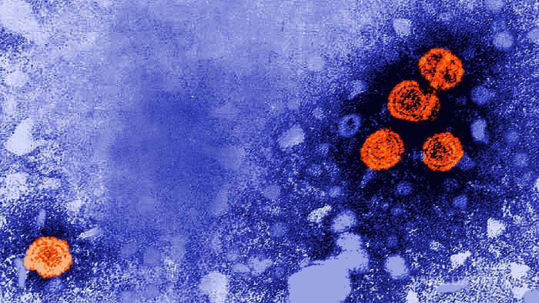 $!Imagen de microscopio del virus de la hepatitis B.