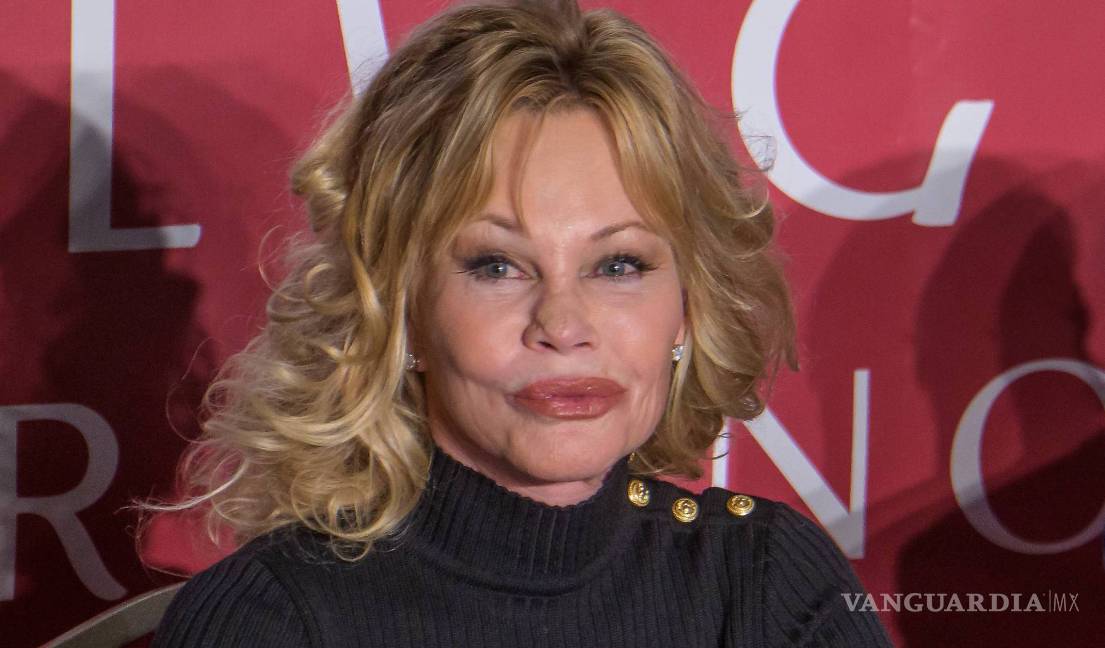 ¿Qué le pasa en la nariz a Melanie Griffith?
