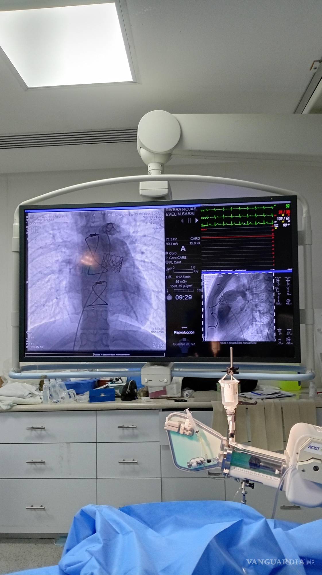 $!El IMSS ofrece este tratamiento de alta tecnología sin costo elevado para los pacientes, a diferencia del sector privado.