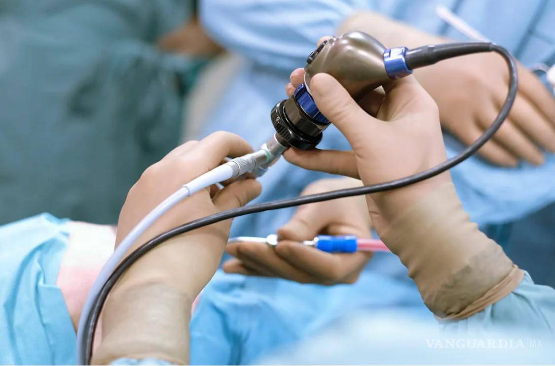 $!La colonoscopia es el estudio clave para detectar y prevenir la evolución de pólipos hacia tumores malignos.