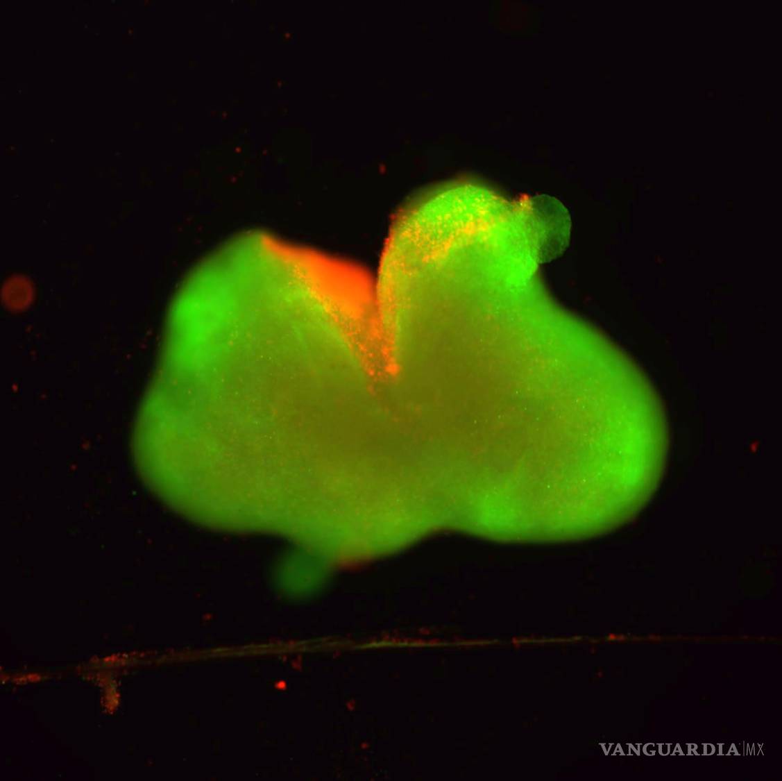$!Imagen fluorescente de un organoide de la médula espinal humana con una laceración representativa de una lesión, en la cual las células muertas son rojas y las células vivas son verdes.