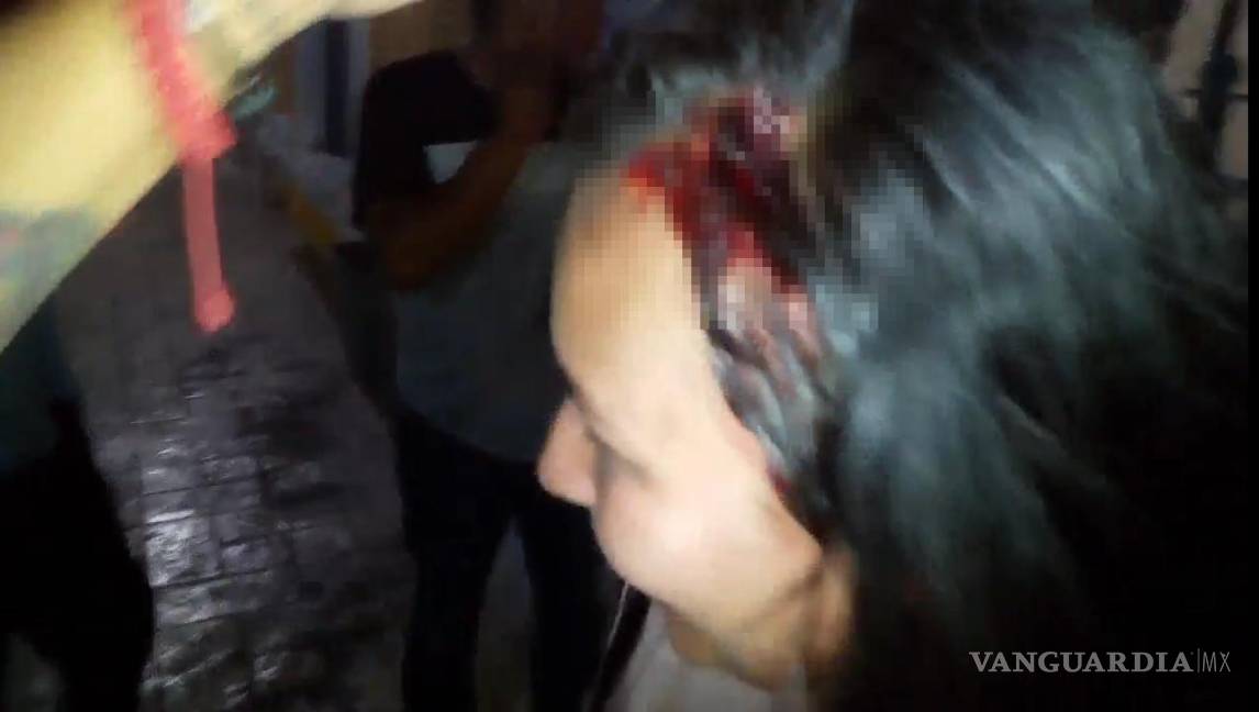 $!Mujer resulta con herida en la cabeza tras una intensa pelea en un bar de Parras.
