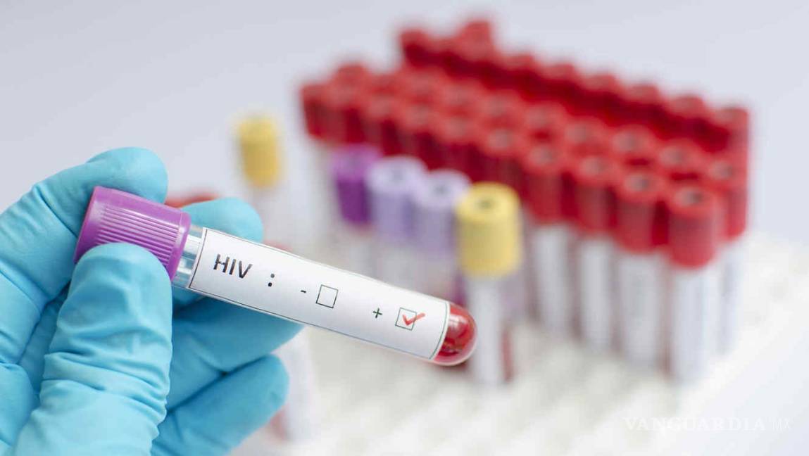 $!En peligro los avances contra el VIH por la lucha contra el COVID-19