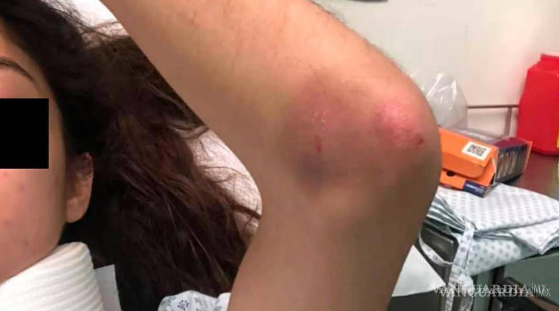 $!En 2020 denunció una agresión de su expareja.