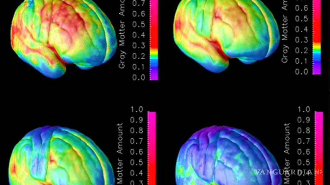 Optogenética, una luz en el cerebro