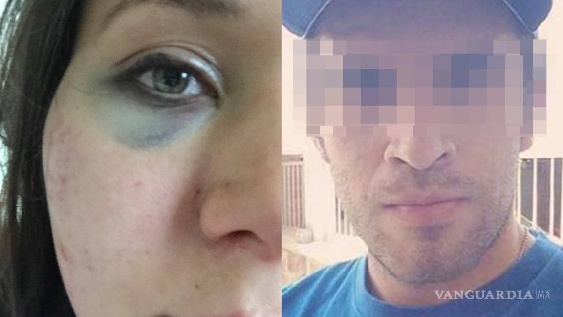 Se vuelve viral denuncia de saltillense golpeada por ‘cortar’ a su novio