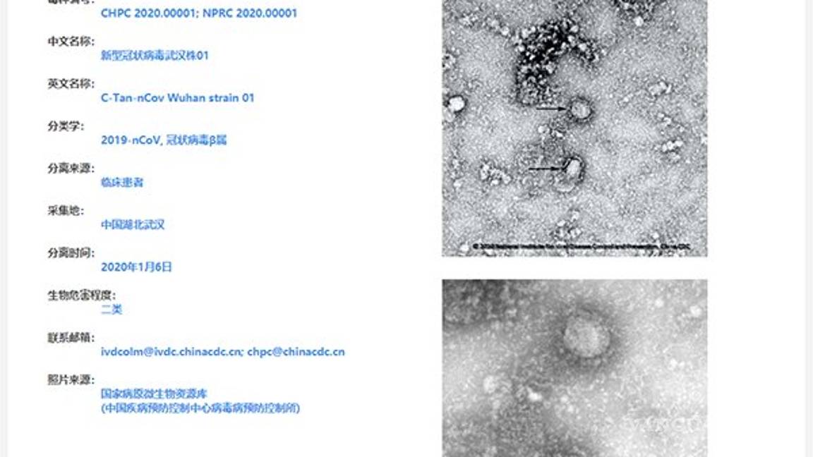 $!Comparten primera imagen del coronavirus visto desde el microscopio