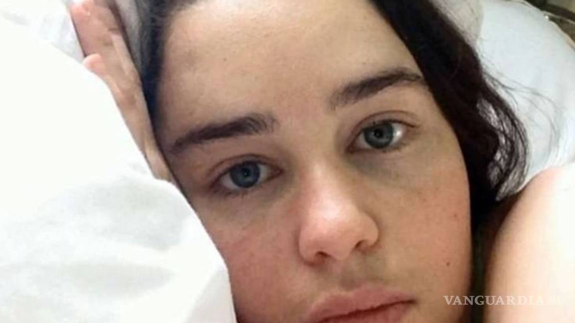 $!Emilia Clarke de Game of Thrones casi pierde la vida y compartió fotos del suceso