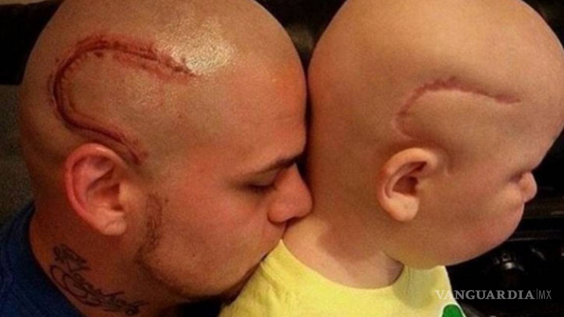 Fallece niño por tumor en el cerebro cuyo padre se tatuó su cicatriz