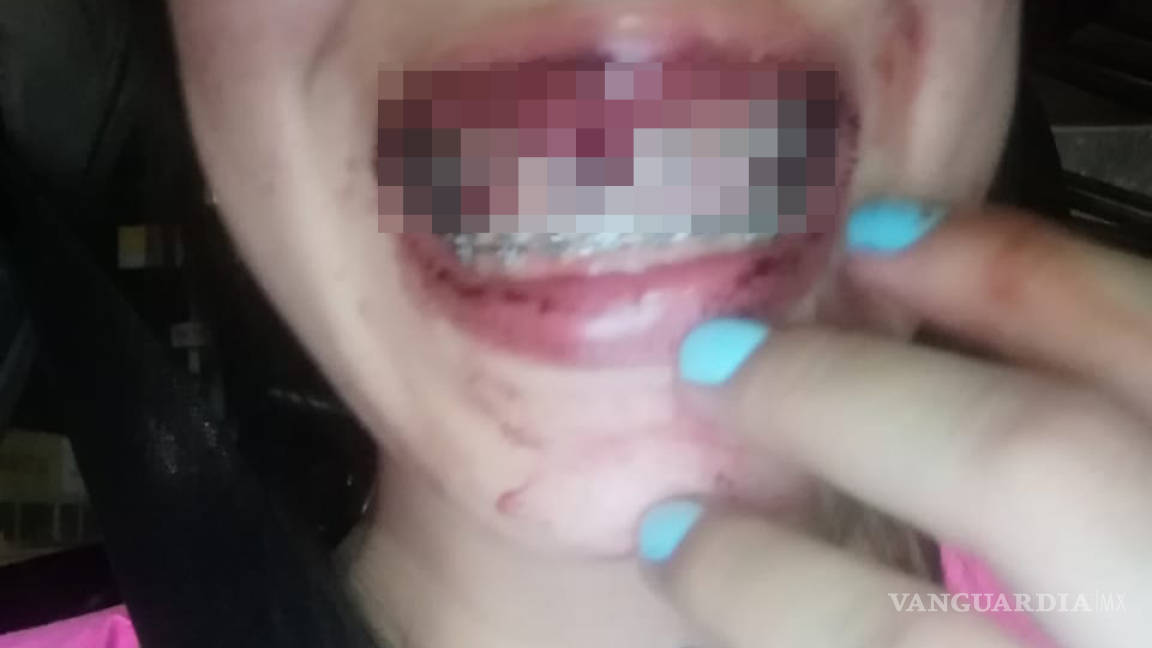 Se viraliza en redes agresión contra mujer saltillense; le tumba los dientes ex pareja