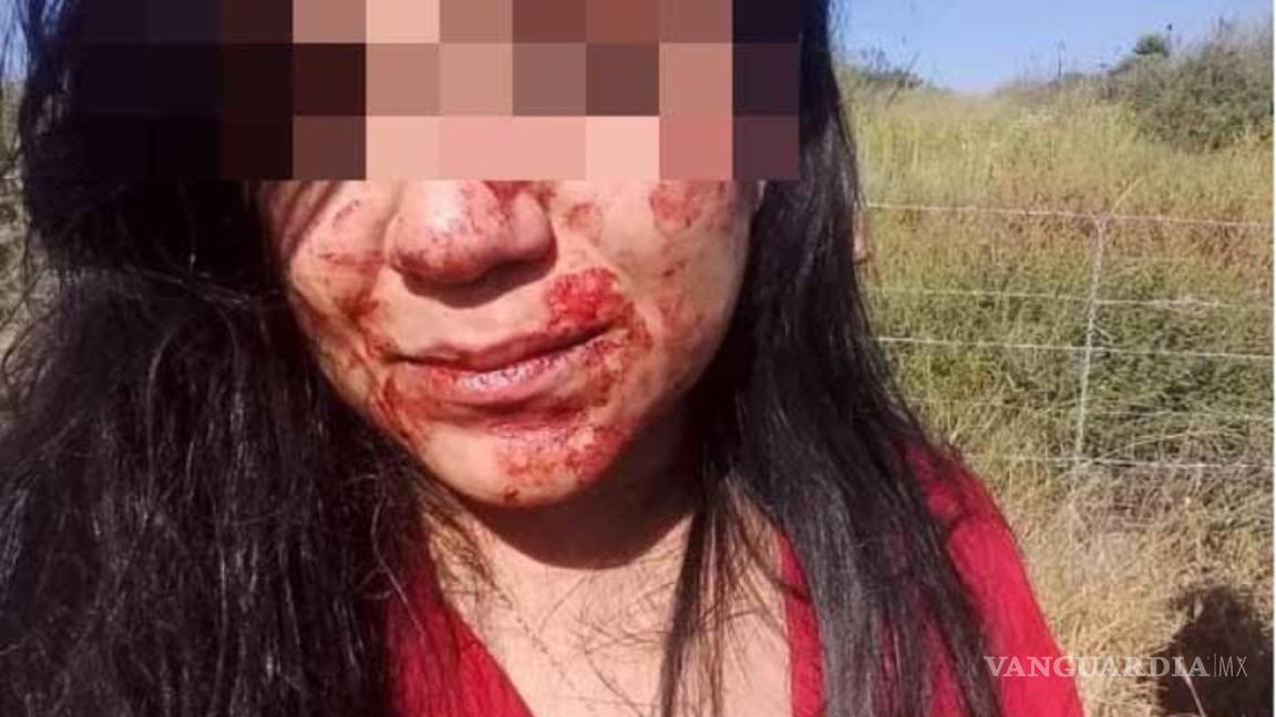 Aún sin castigo joven saltillense que dio golpiza a su novia