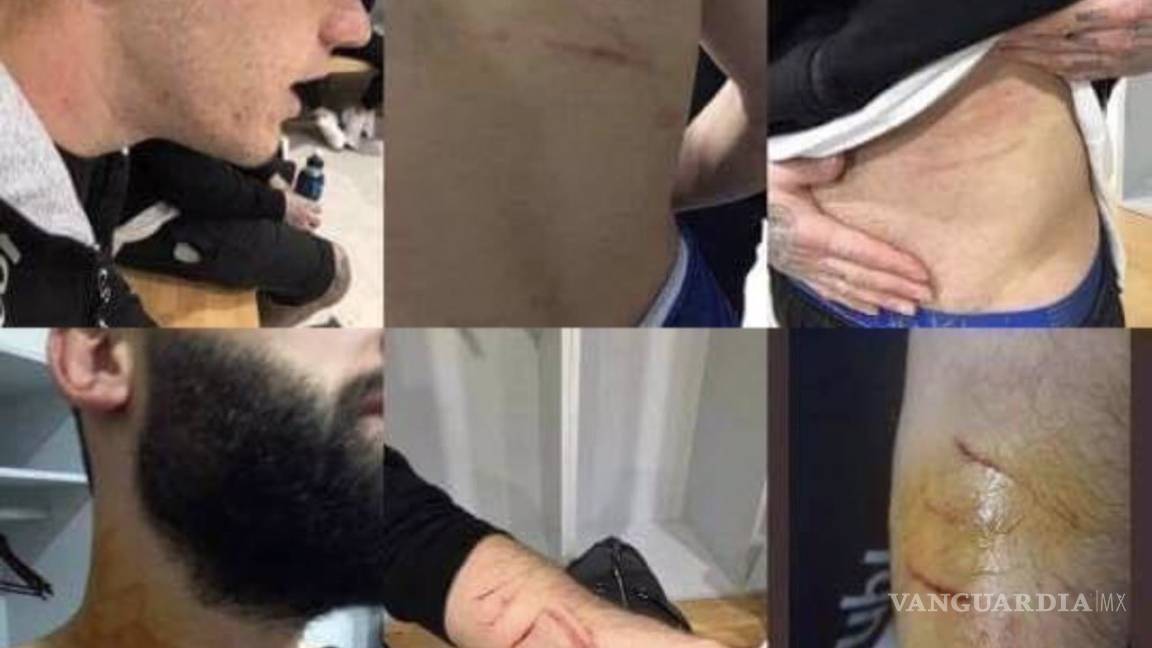 Un jugador turco agredió a sus rivales...¡con una navaja de afeitar!
