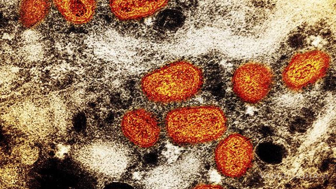 $!Imagen captada en el que se ven partículas de viruela símica, en anaranjado, encontradas dentro de una célula infectada (marrón) cultivada en un laboratorio.