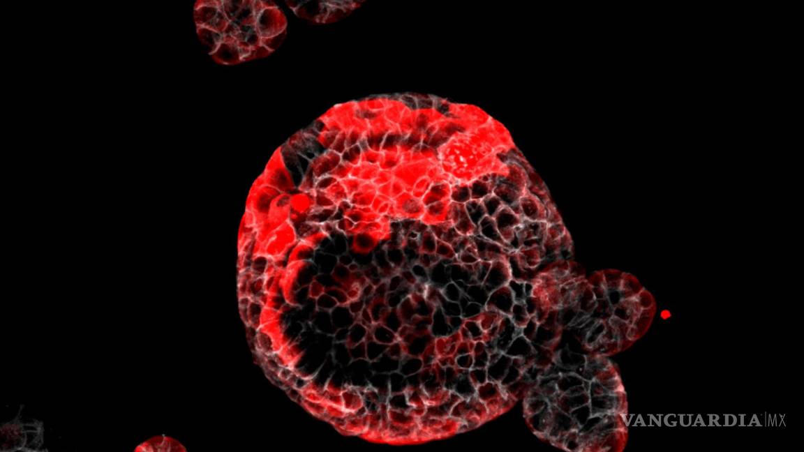 Descubren las células malignas responsables de que vuelva aparecer el cáncer y originan las muertes por metástasis