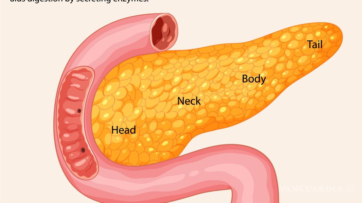 $!Lo más habitual es que el cáncer se origine en la región del páncreas llamada cabeza (60% de los casos), pero también puede surgir en la zona conocida como cuerpo o cola del páncreas.