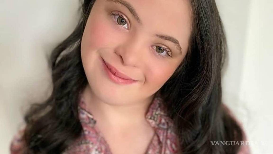 $!Gucci elige a modelo con síndrome de Down como su nuevo rostro