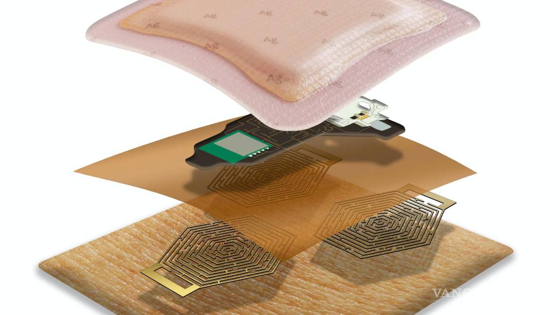 $!Esquema del sensor ECG, compuesto por un apósito autoadhesivo, elementos electrónicos y tres electrodos 'secos'.