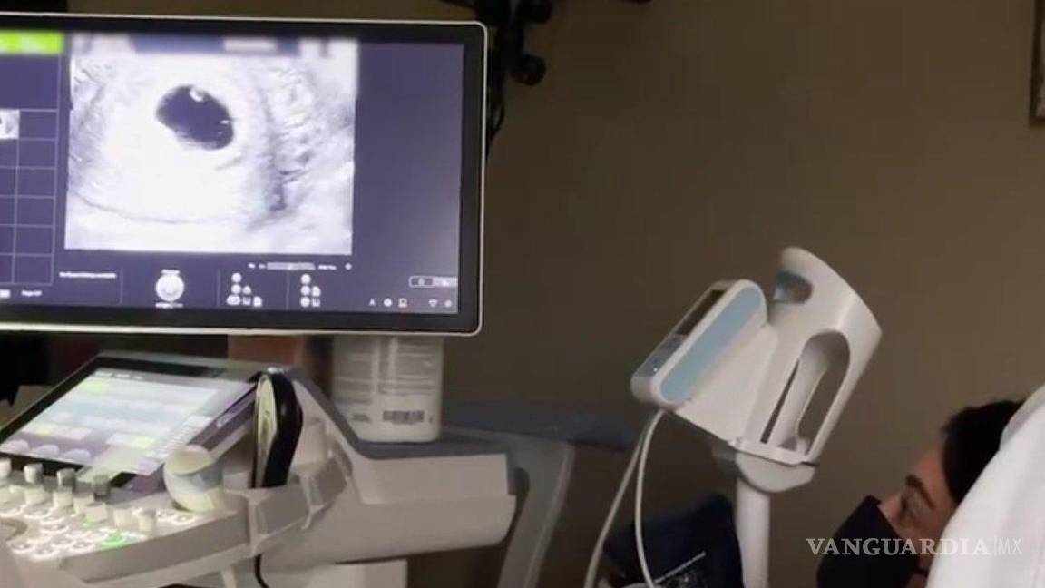 $!El clip también cuenta con imágenes y clips de los primeros ultrasonidos de Jenner