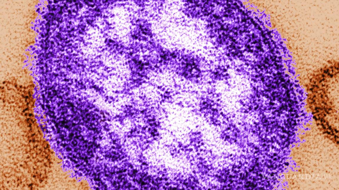$!Una imagen de microscopio electrónico de una partícula del virus del sarampión. Los brotes de sarampión en EU están aumentando la preocupación de los expertos.