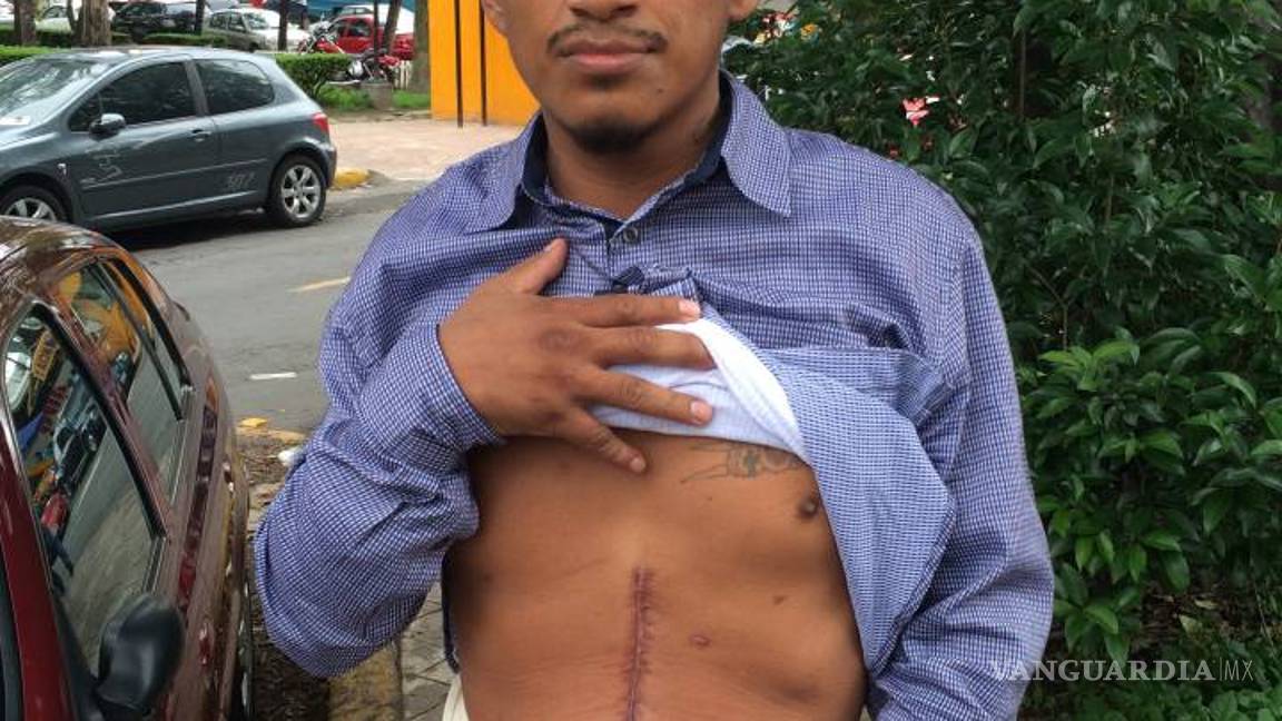 $!“Un balazo me afectó el bazo, el hígado, el pulmón izquierdo y el riñón”: Heridos de Nochixtlán