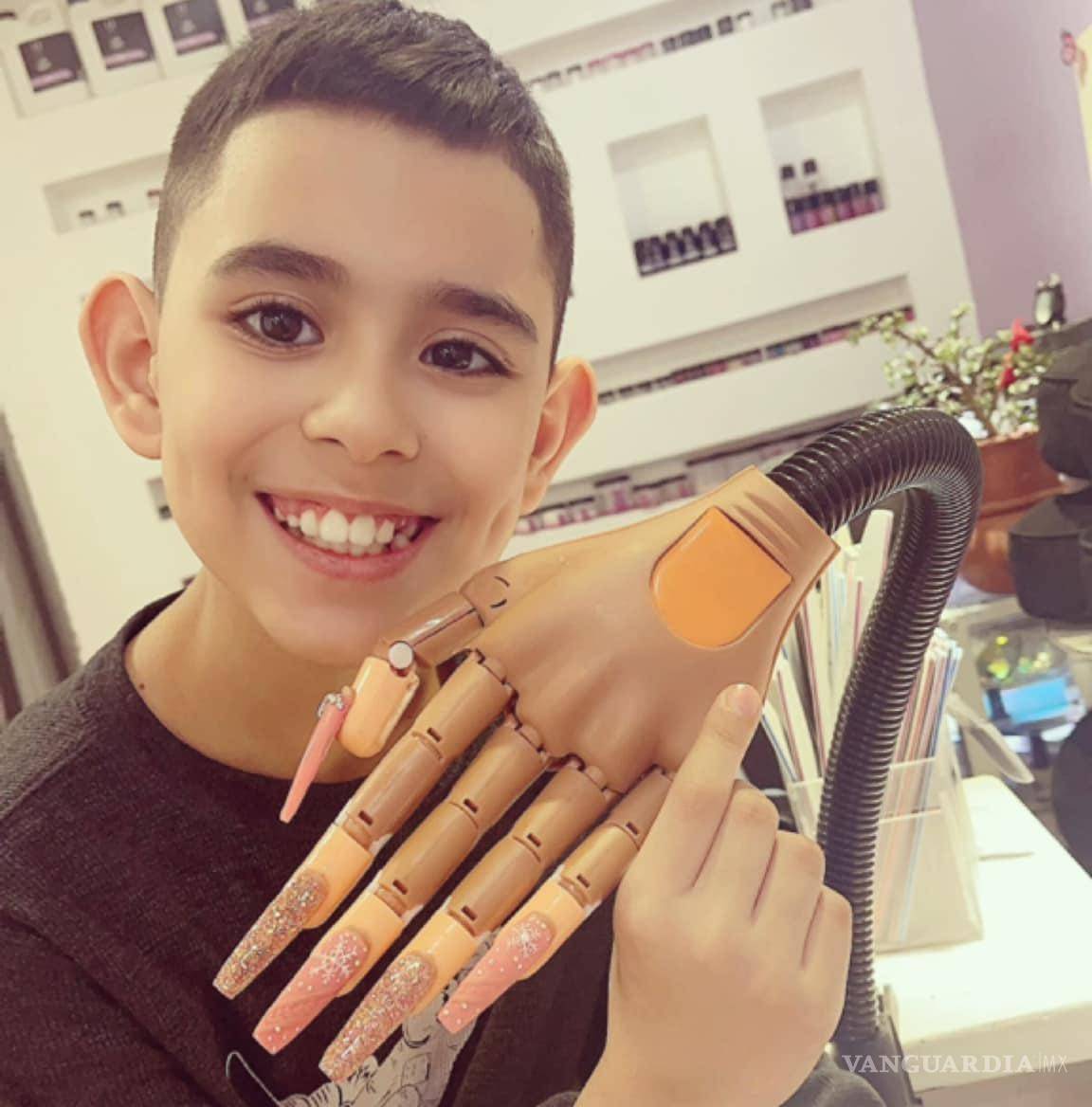 $!Viral: Niño aplica uñas de acrílico para ayudar en operación de su hermanito