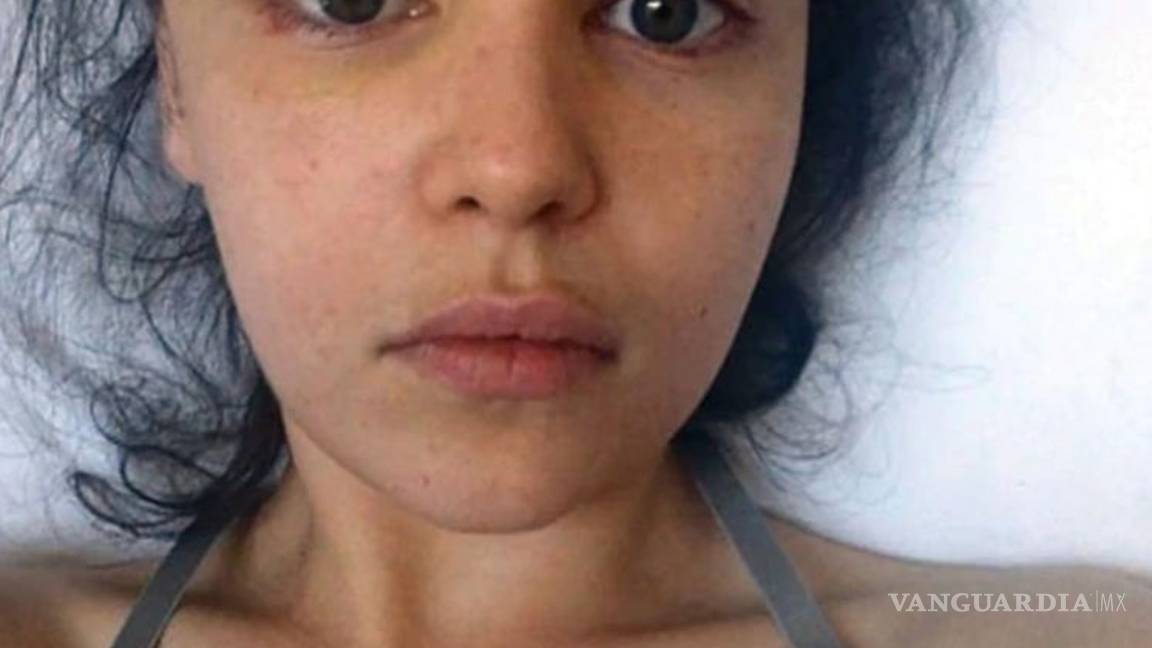 $!Emilia Clarke de Game of Thrones casi pierde la vida y compartió fotos del suceso