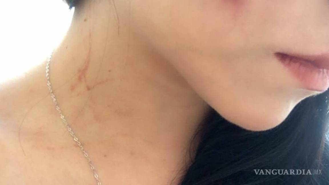 $!Porrista de Saraperos denuncia golpiza de su novio