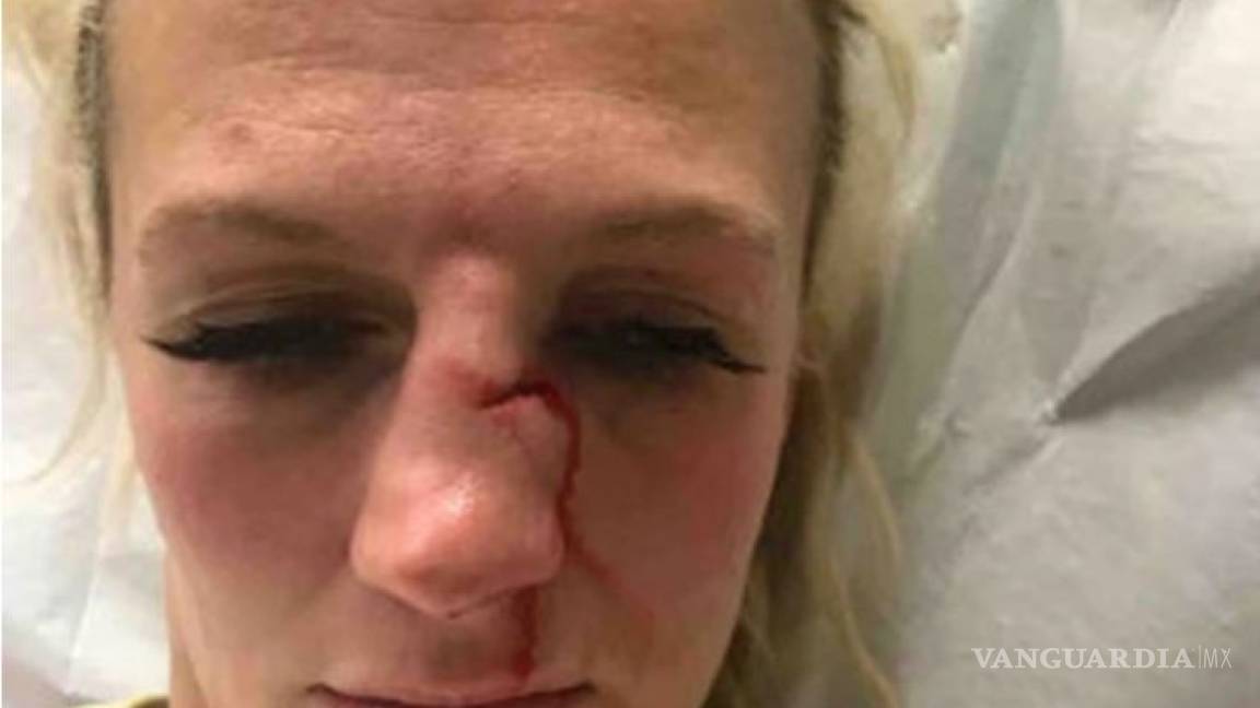 $!La brutal agresión de una peleadora de MMA a manos de su exnovio