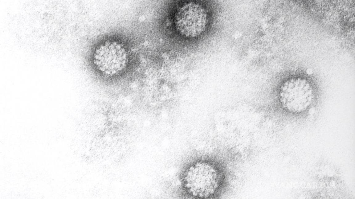 $!El virus del papiloma humano es la infección de transmisión sexual más común en todo el mundo. Se estima que más del 80 % de las mujeres están expuestas a él.