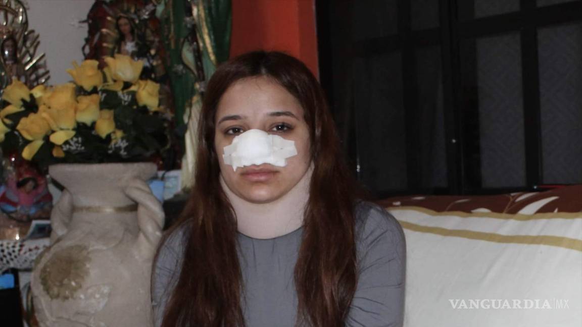 Denuncian a ex policía de Saltillo por violentar a su pareja; agresor huye