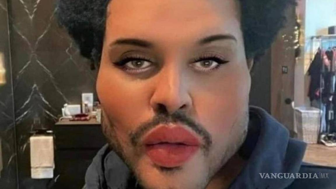 $!The Weeknd (y los árbitros) se llevan los memes del Super Bowl LV