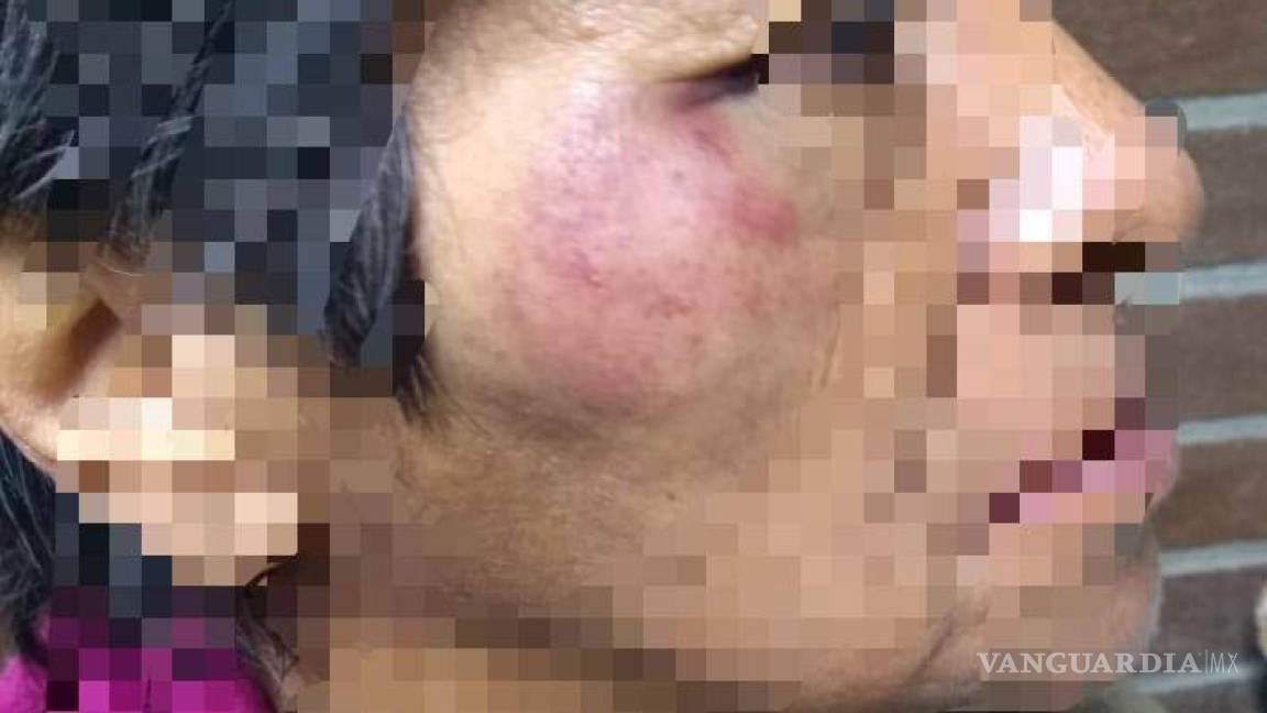 Policías de Arteaga golpean y gasean a dos mujeres