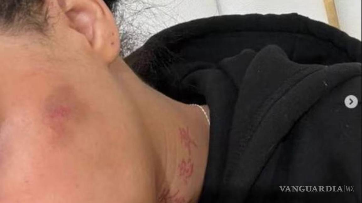 $!Yailin publicó una foto como evidencia de la violencia que sufrió.