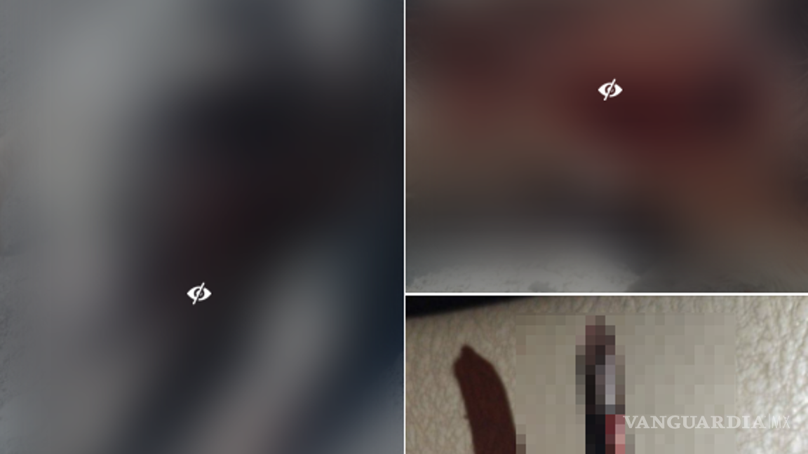 $!El dueño del perro atacado compartió su historia en redes, buscando justicia para su mascota herida.