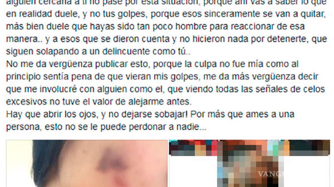 $!Porrista de Saraperos denuncia golpiza de su novio