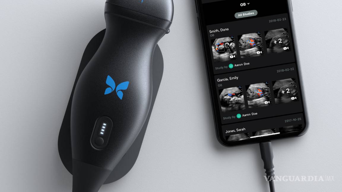 $!Con Butterfly iQ ya puedes ver tus ecografías desde tu celular