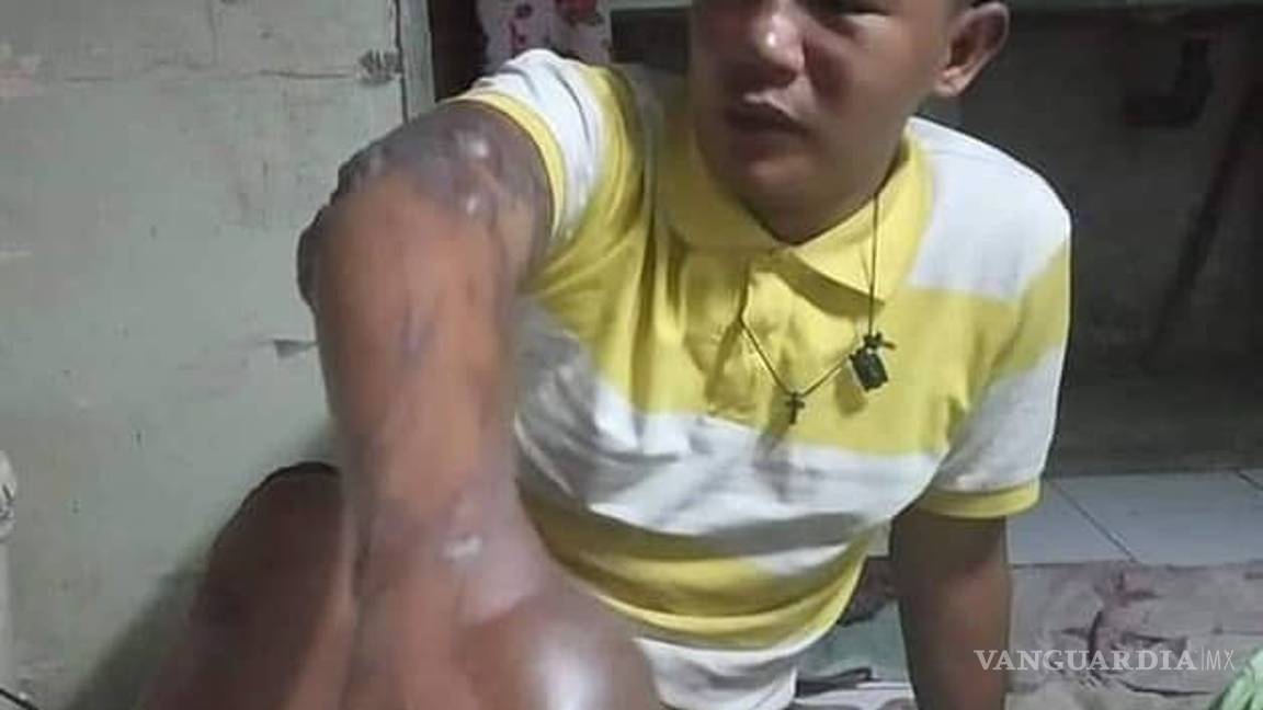 $!'Broma' de niños deja a vendedor de globos envuelto en llamas