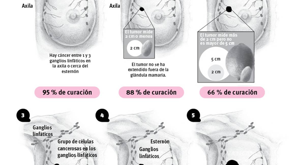$!Cruzada del Municipio de Saltillo contra cáncer de mama