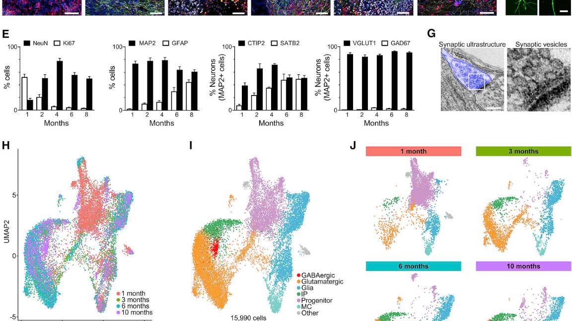 $!Cerebros diminutos creados en laboratorio desarrollan redes neuronales funcionales