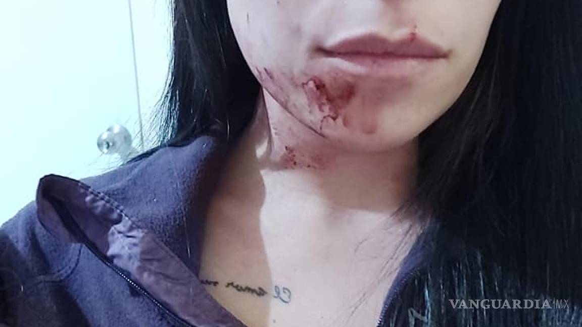 Policía y su esposa dan una golpiza a mujer en Coahuila