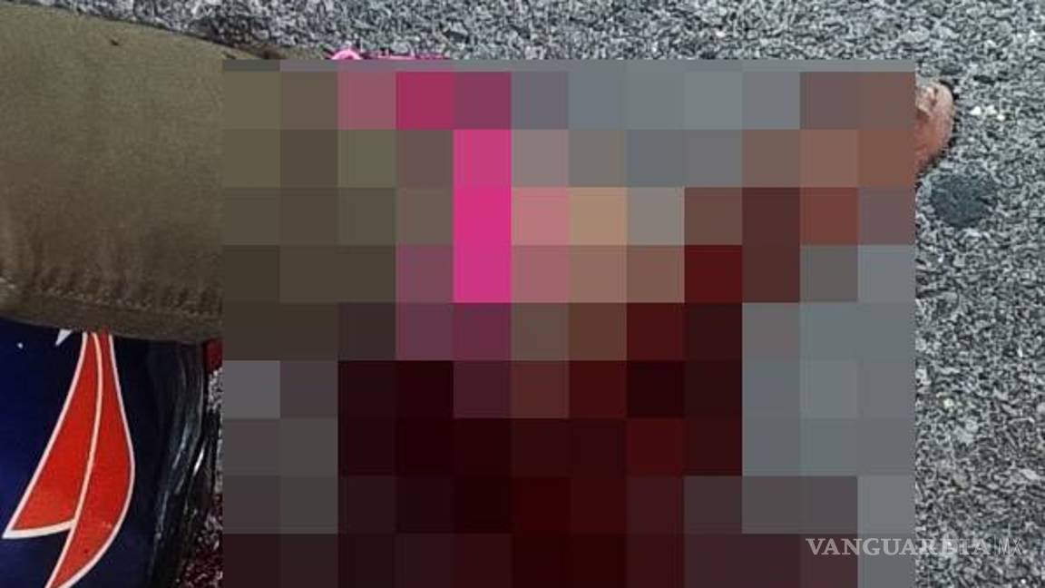 $!La víctima sufrió desprendimiento del talón y lesiones graves en el pie.