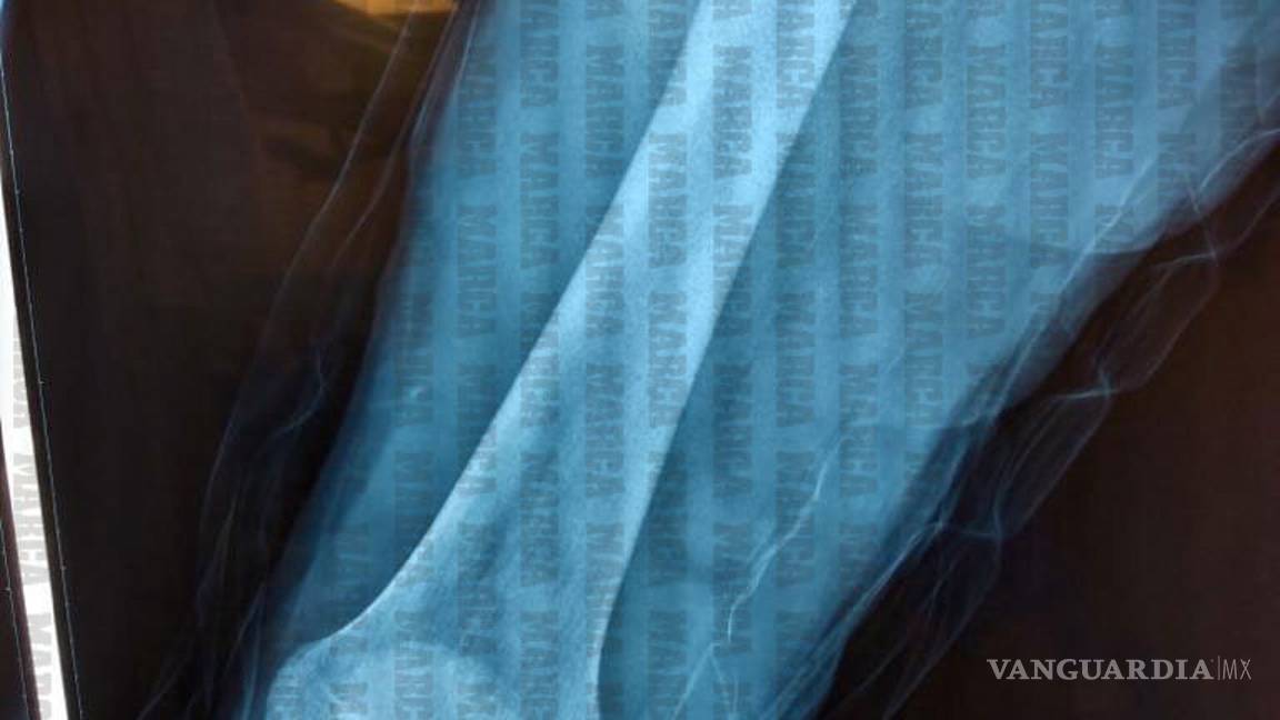 $!Estas son las imágenes de la operación de Giovani dos Santos (se recomienda discreción)