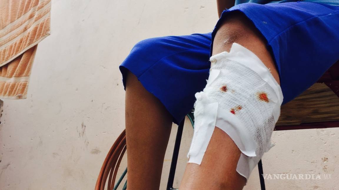 $!Nadie se hizo cargo del pitbull que mordió al niño de 11 años en Saltillo