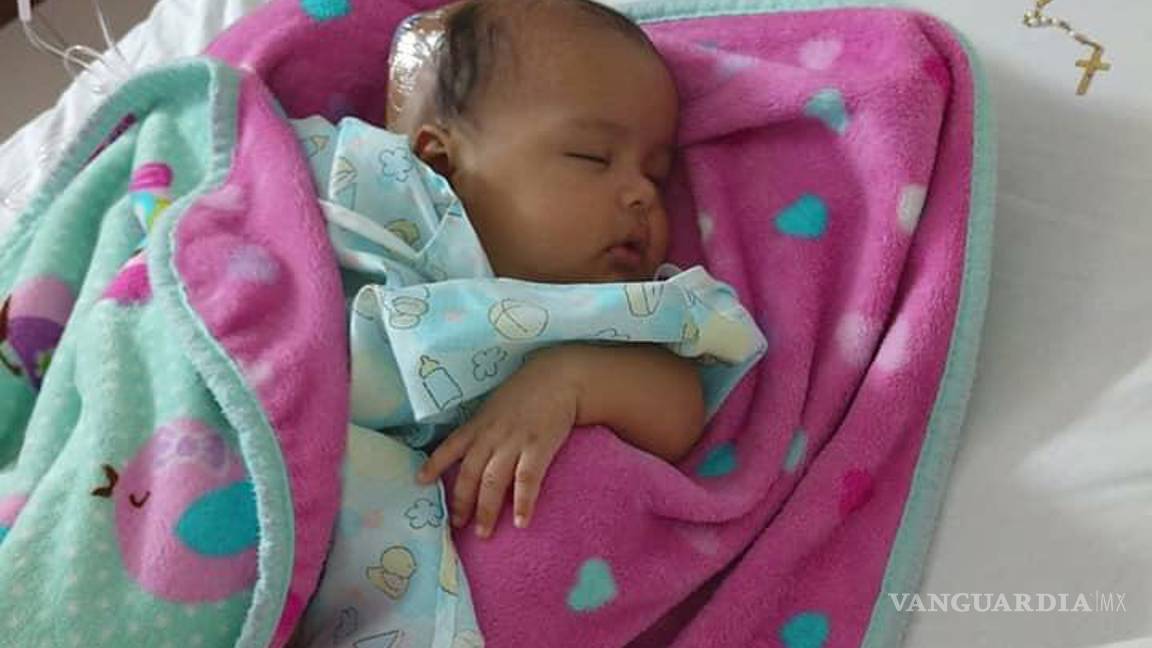 $!Piden apoyo para niña de Saltillo que padece hidrocefalia