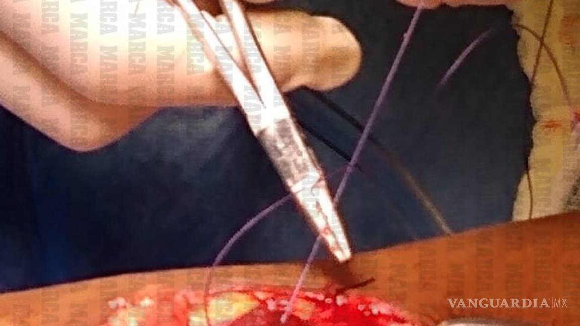 $!Estas son las imágenes de la operación de Giovani dos Santos (se recomienda discreción)