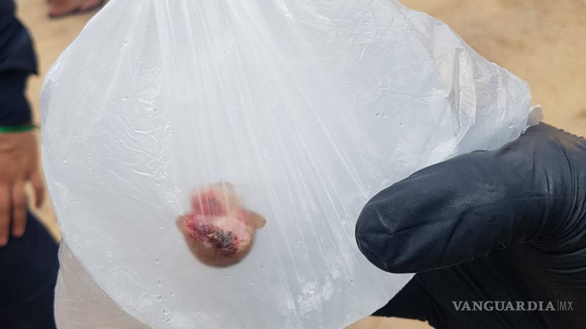 $!Ataca perro a peatón y le arranca un dedo