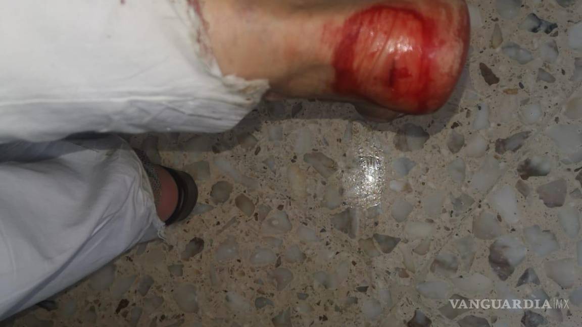 $!Necesitó suturas en algunas de las heridas, que fueron profundas.