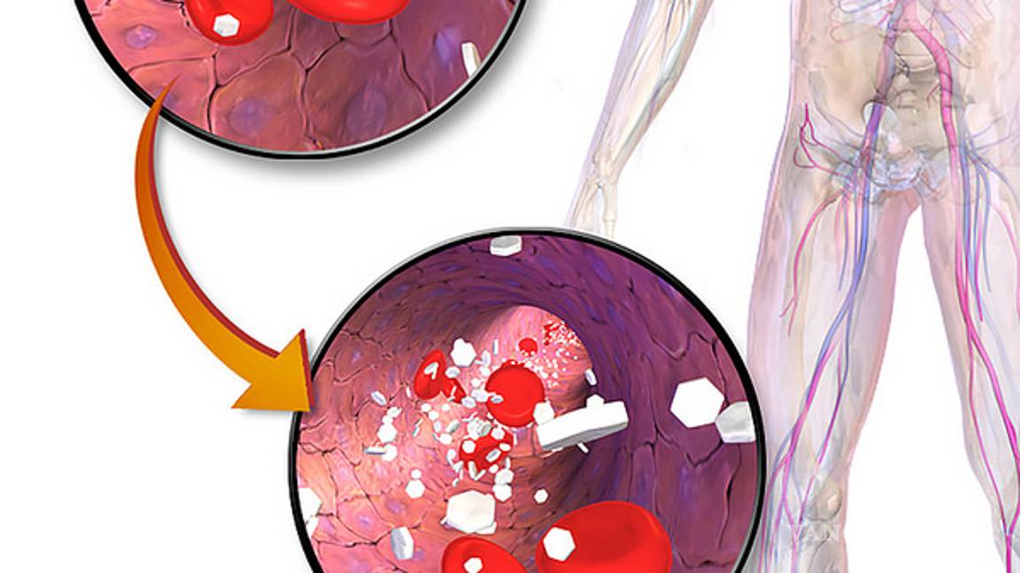 $!Cuál es el riesgo de suministrar tipo y dosis incorrectas de insulina en el paciente diabético