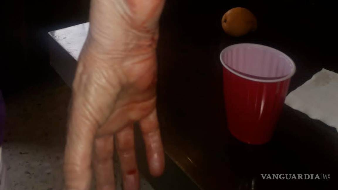 $!La maestra sufrió heridas en varias partes de su cuerpo.