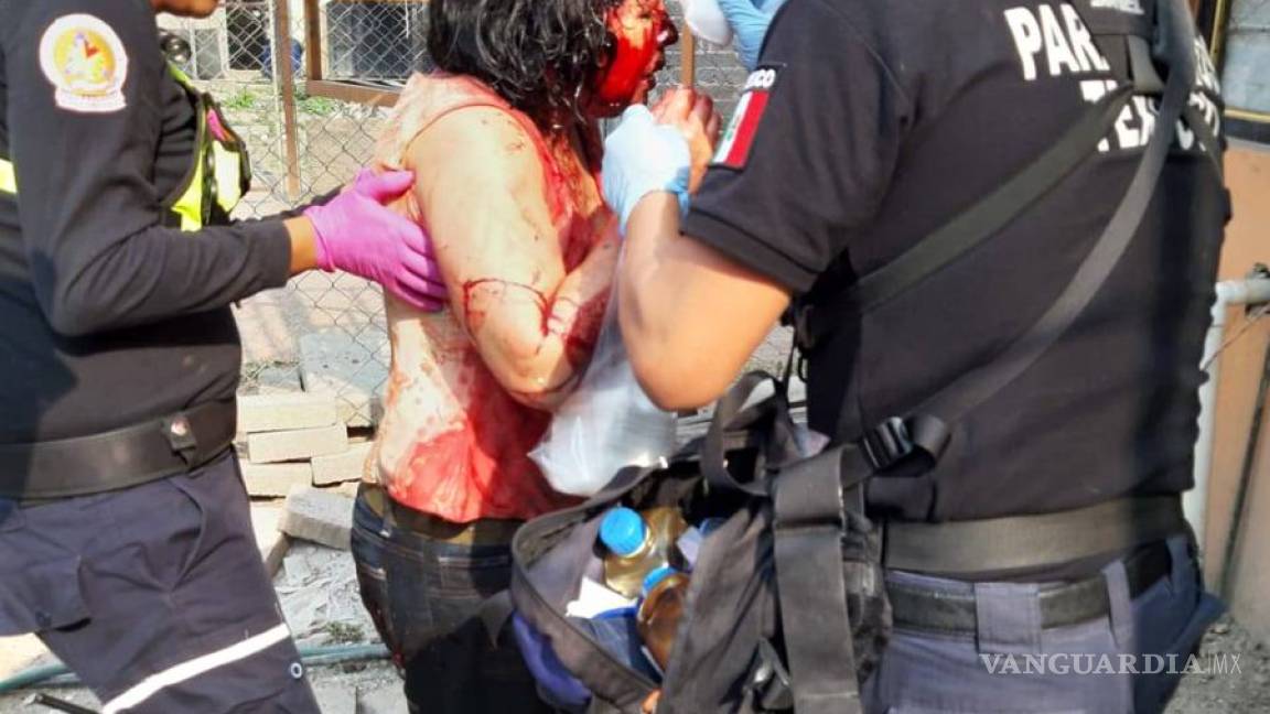 Dos mujeres fueron atacadas por manada de perros en Texcoco